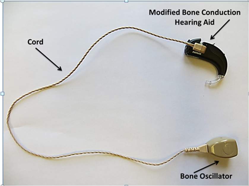 Bone Anchored Hearing Aid 